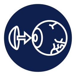 زراعة القرنية