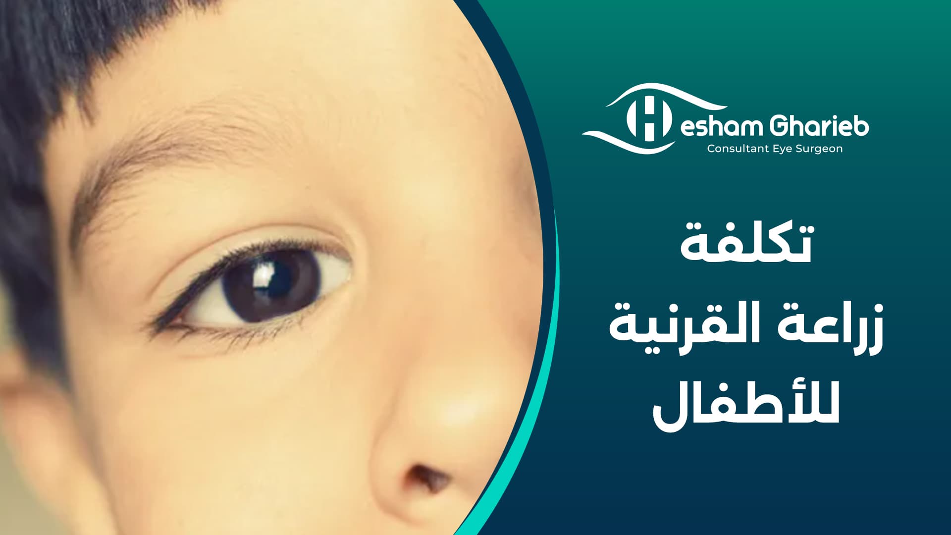 تكلفة زراعة القرنية للأطفال – كم سعر عملية زراعة القرنية للأطفال
