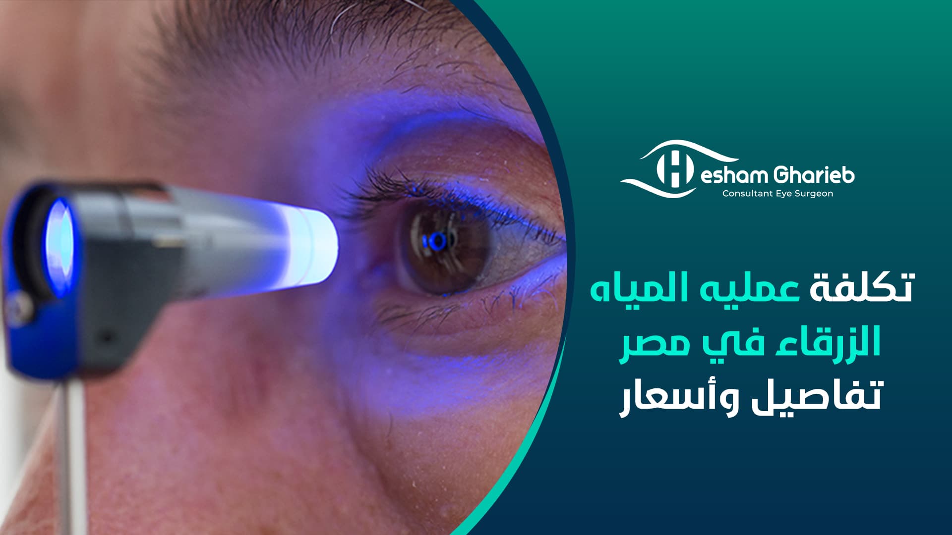 تكلفة عمليه المياه الزرقاء في مصر – تفاصيل وأسعار
