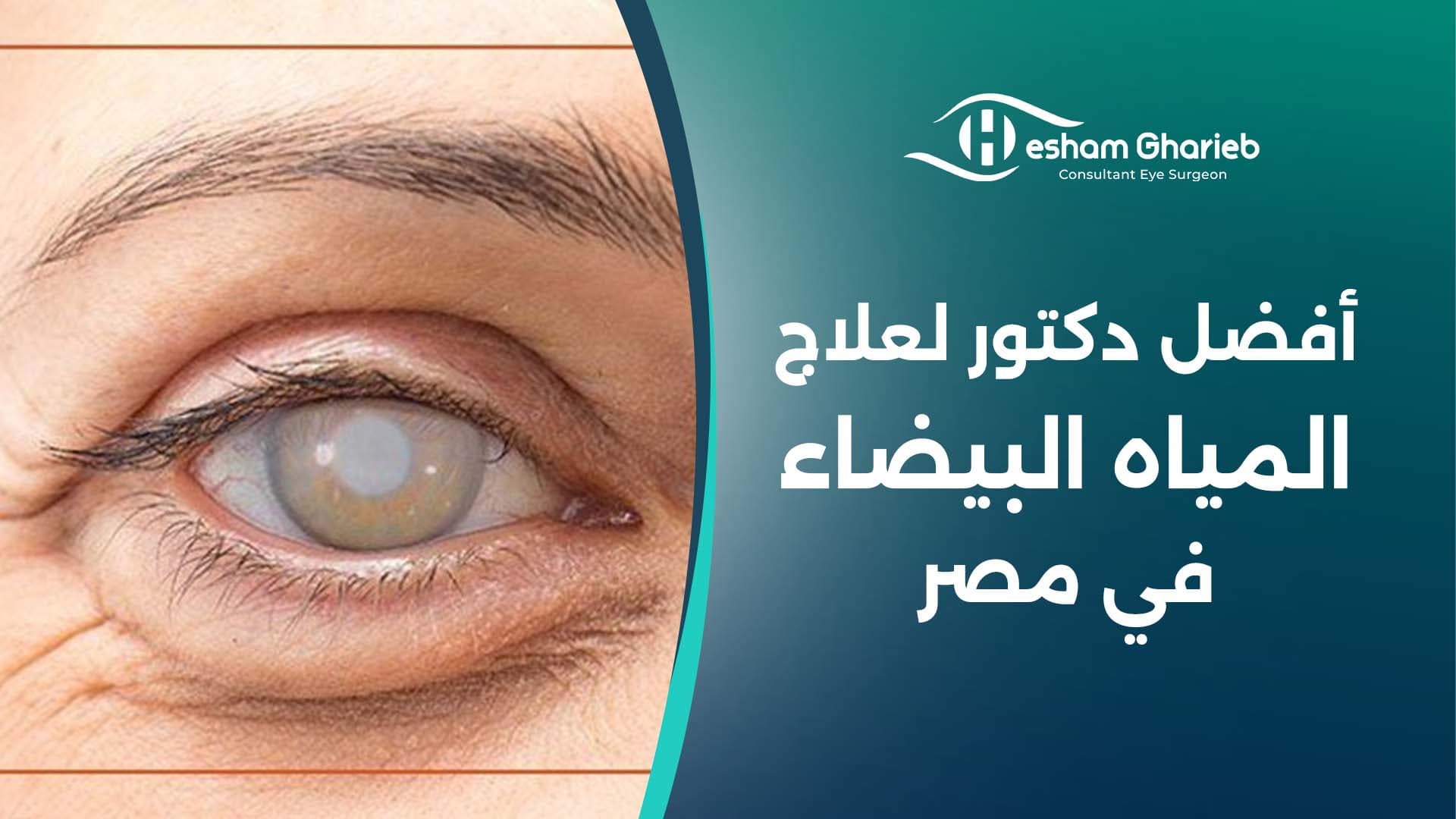 أفضل دكتور لعلاج المياه البيضاء في مصر 2025