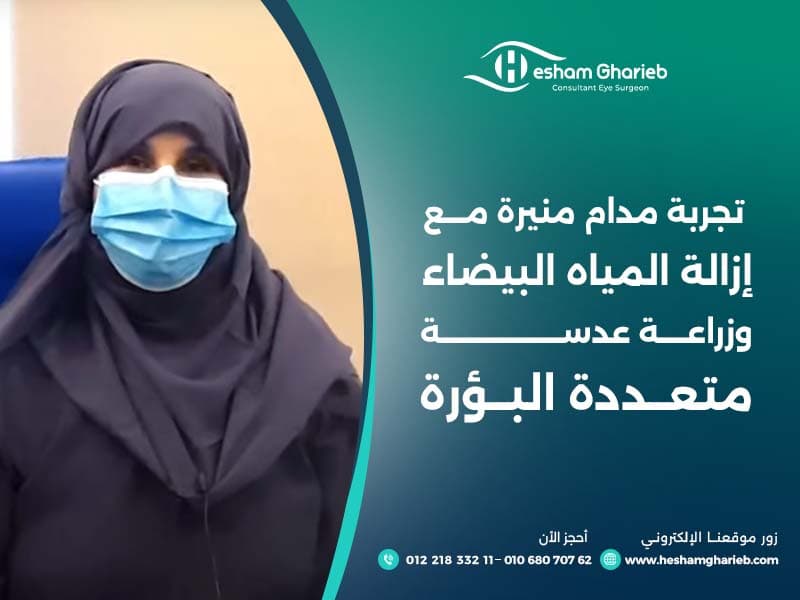 تجربة مدام منيرة مع إزالة المياه البيضاء وزراعة عدسة متعددة البؤرة