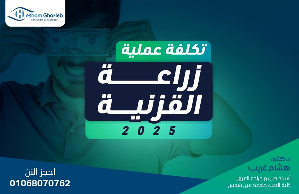 تكلفة عملية زراعة القرنية 2025