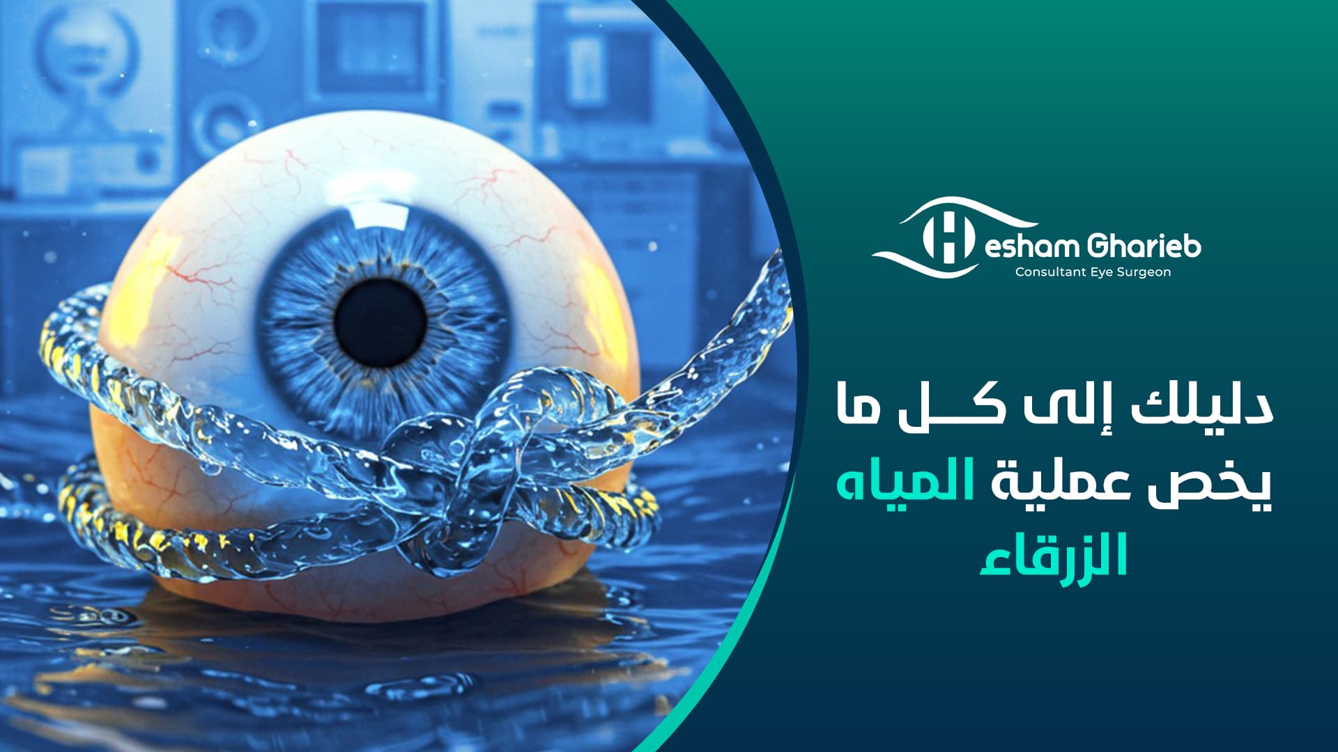 دليلك إلى كل ما يخص عملية المياه الزرقاء