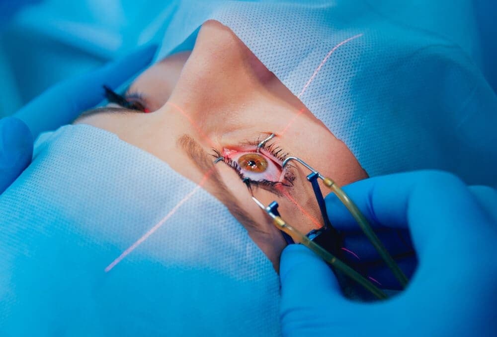 Lasik: Frequent Questions