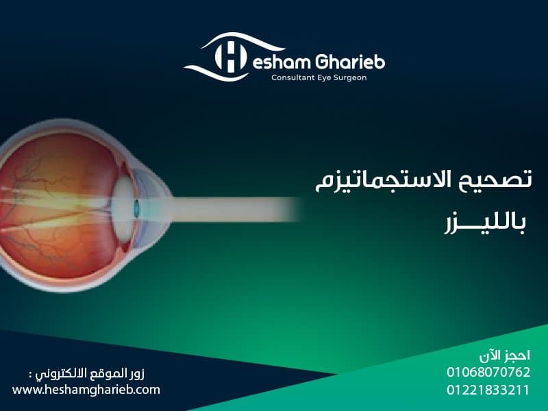 تصحيح الاستجماتيزم بالليزر: الحل الأمثل لتحسين الرؤية