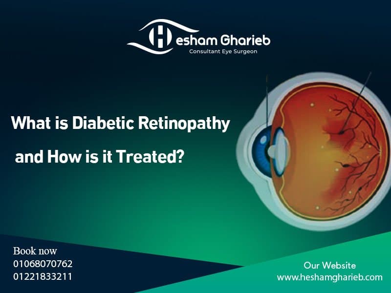 What is Diabetic Retinopathy? Symptoms & Treatment Options