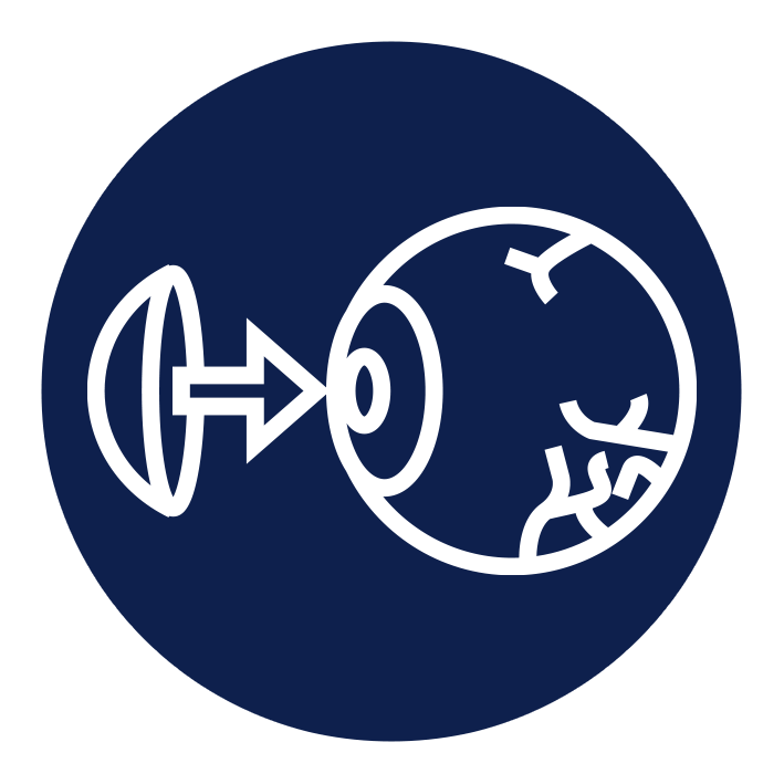 زراعة القرنية