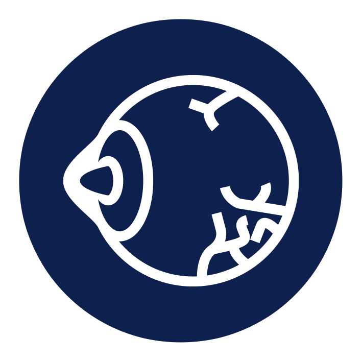 علاج القرنية المخروطية