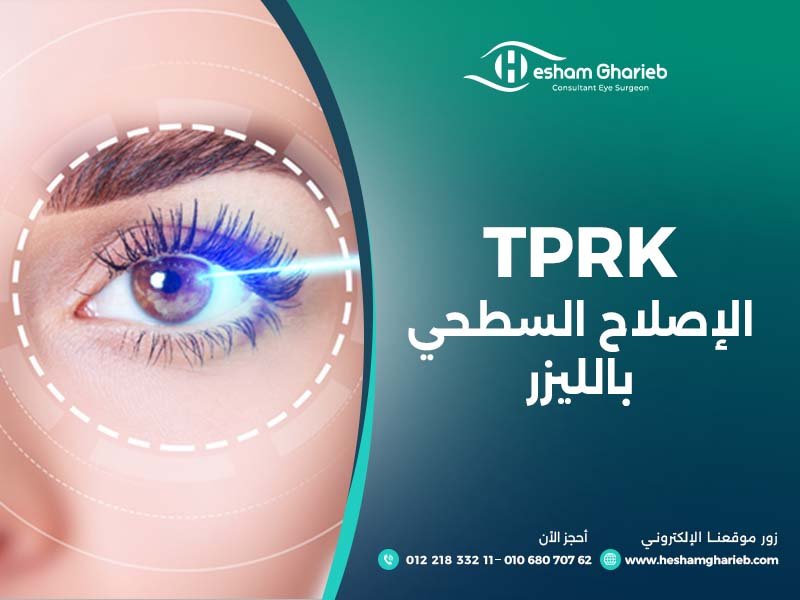 TPRK الإصلاح السطحي بالليزر TPRK الإصلاح السطحي بالليزر