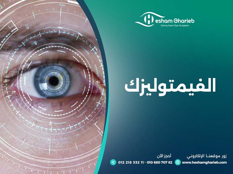 الفيمتوليزك