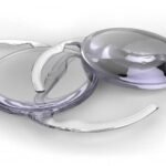 Cost of Cataract Surgery