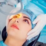 تعليمات قبل و بعد عملية الليزك