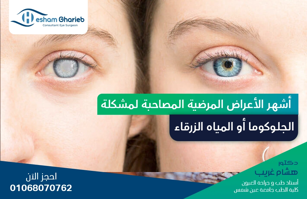 أشهر الأعراض المرضية المصاحبة لمشكلة الجلوكوما أو المياه الزرقاء