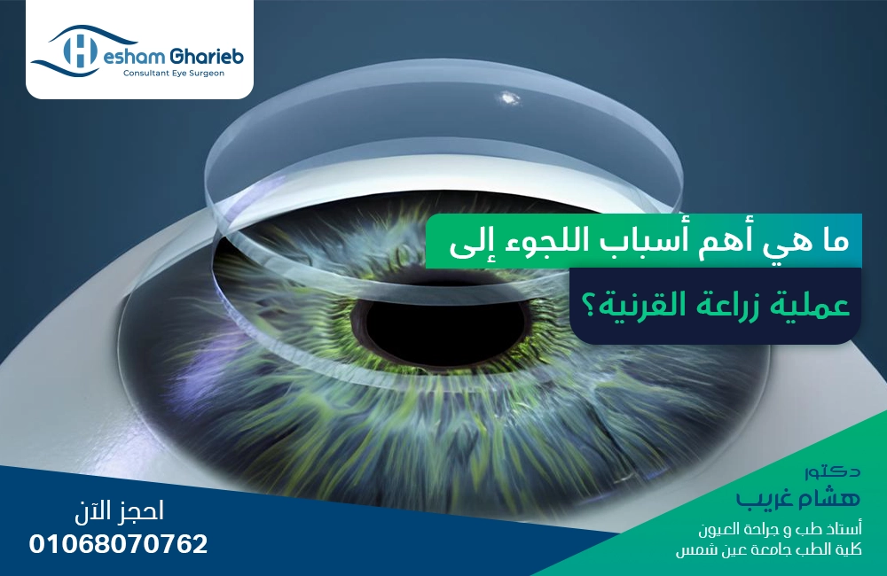 ما هي أهم أسباب اللجوء إلى عملية زراعة القرنية؟