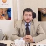 أفضل دكتور عيون تخصص قرنية