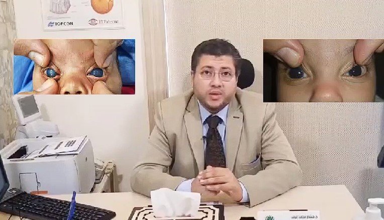 أفضل دكتور عيون تخصص قرنية