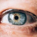 تفاصيل وأسعار عملية تصليب القرنية