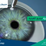 دليلك الشامل عن عملية ترقيع (زرع) القرنية