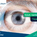 عملية تثبيت القرنية