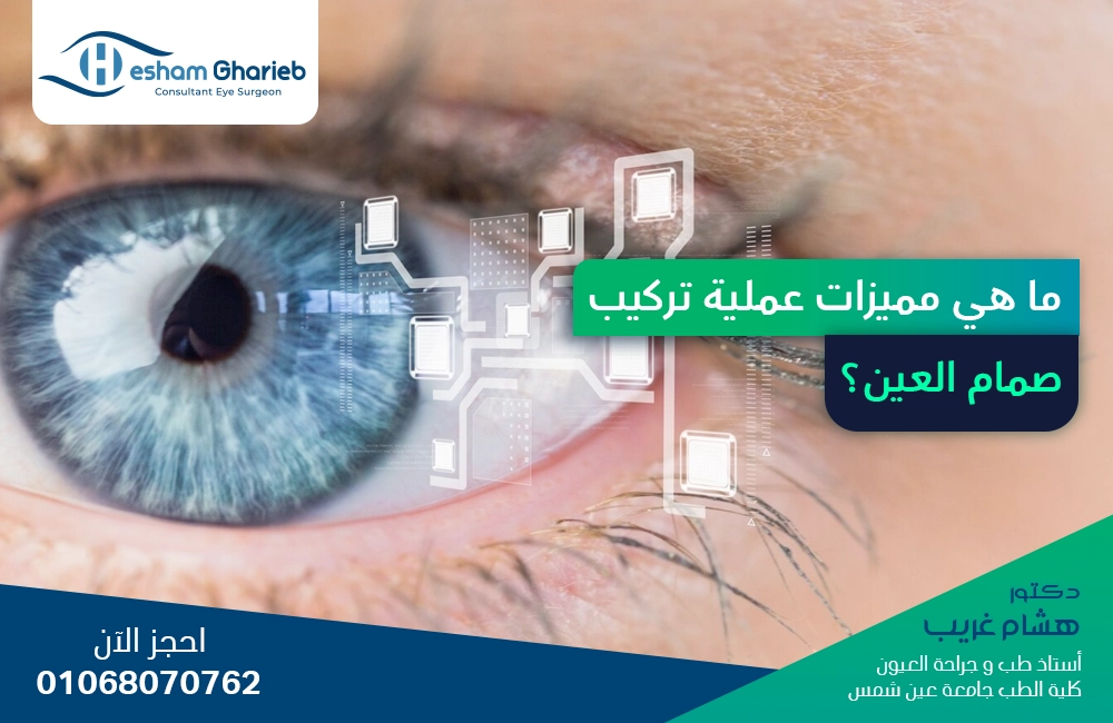 ما هي مميزات عملية تركيب صمام العين؟