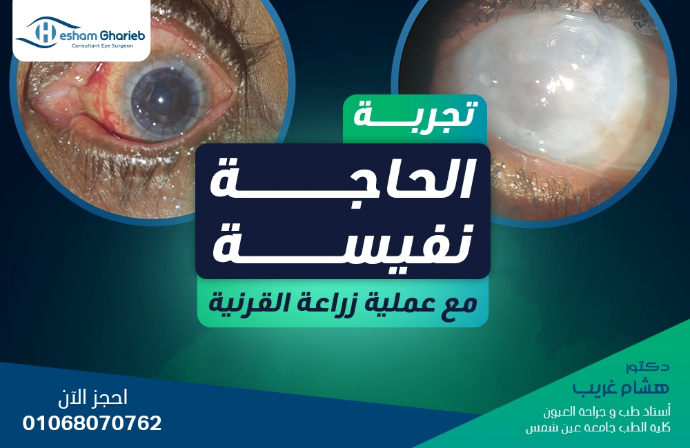 تجربة الحاجة نفيسة مع زراعة القرنية