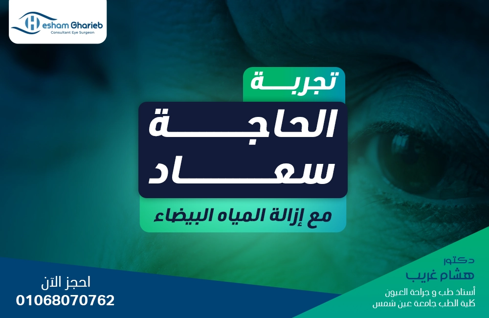 إزالة المياه البيضاء