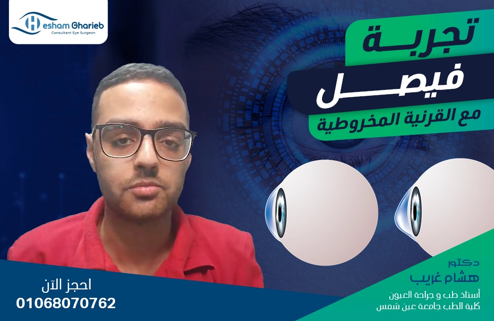 تجربة فيصل مع القرنية المخروطية
