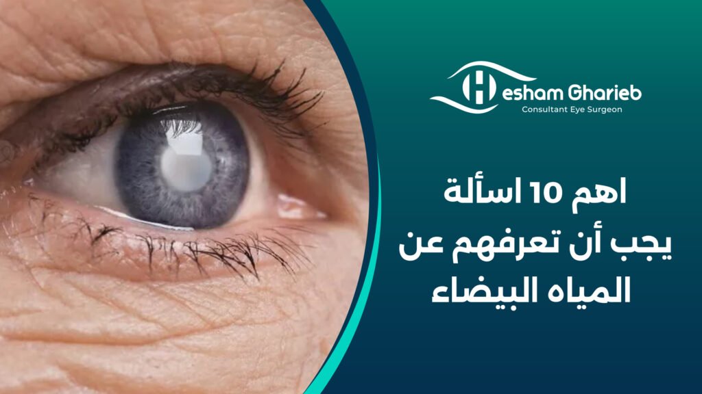 اهم 10 اسألة يجب أن تعرفهم عن المياه البيضاء