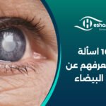 اهم 10 اسألة يجب أن تعرفهم عن المياه البيضاء