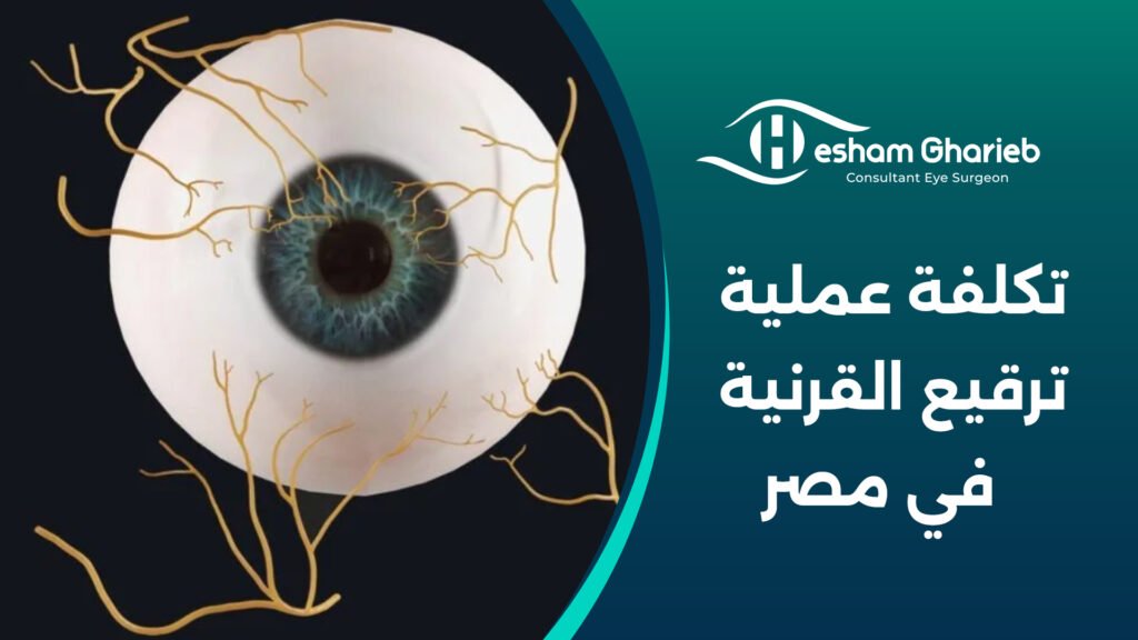 تكلفة عملية ترقيع القرنية في مصر