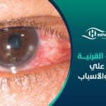 التهاب القرنية – تعرف علي الأعراض والأسباب