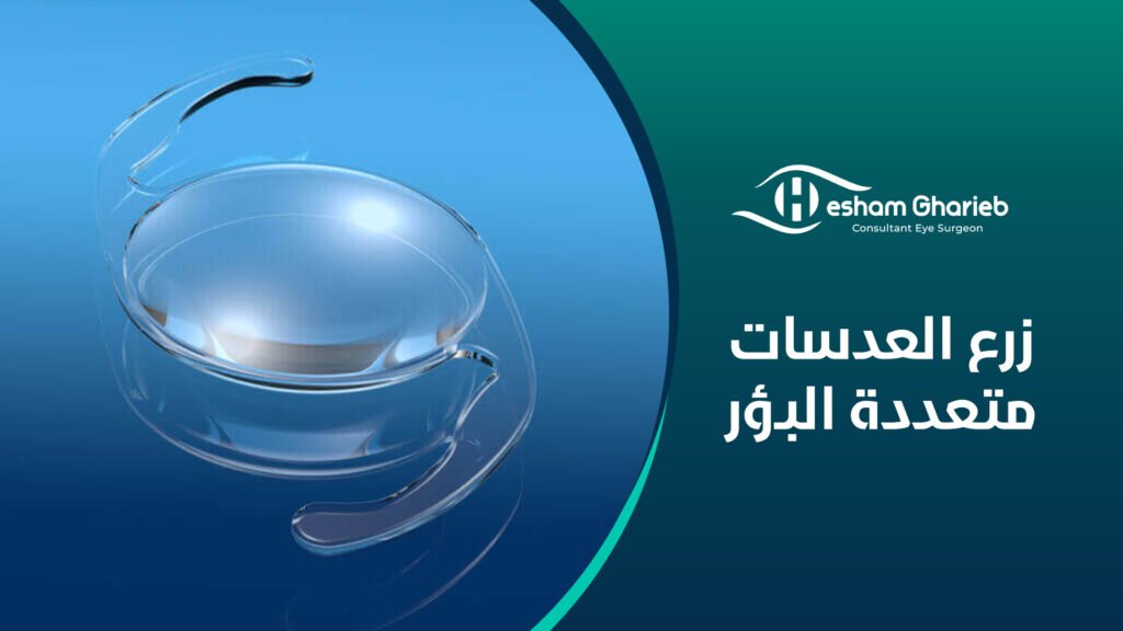 زرع العدسات متعددة البؤر