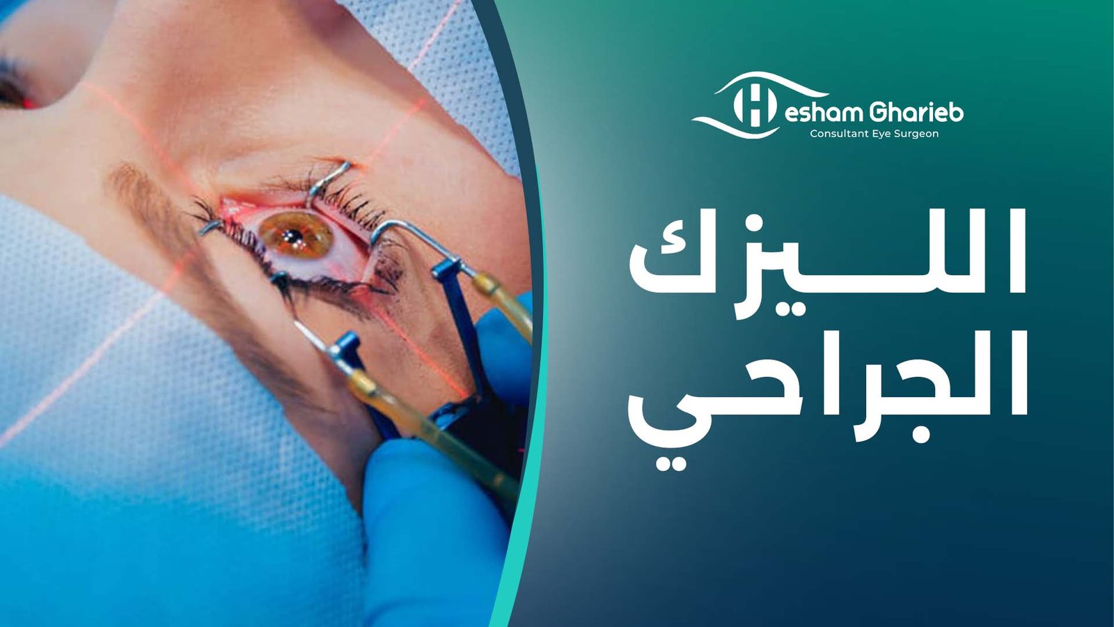 الليزك الجراحي