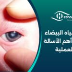 عملية المياه البيضاء للأطفال وأهم الأسالة عن العملية