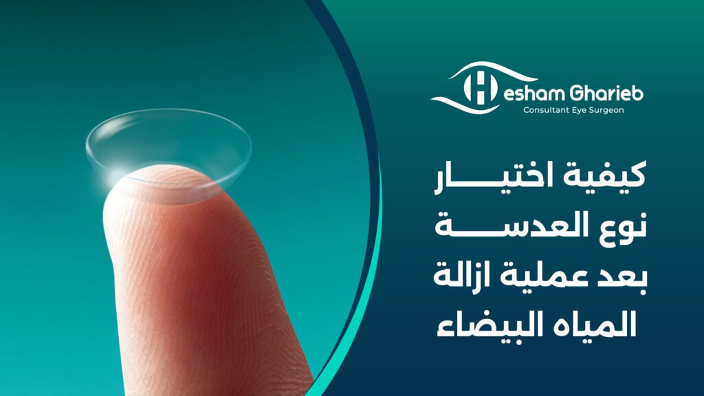 كيفية اختيار نوع العدسة بعد عملية ازالة المياه البيضاء