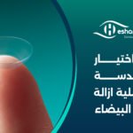 كيفية اختيار نوع العدسة بعد عملية ازالة المياه البيضاء