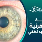 تجربة زرع القرنية مع عم عيد لطفي