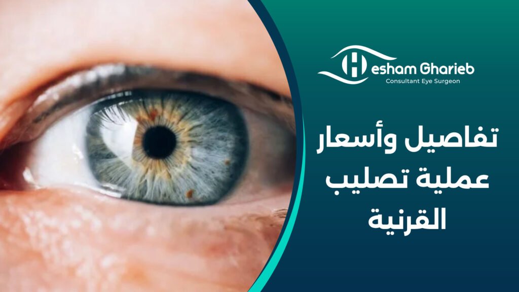 تفاصيل وأسعار عملية تصليب القرنية