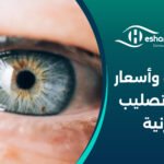 تفاصيل وأسعار عملية تصليب القرنية