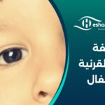 تكلفة زراعة القرنية للأطفال – كم سعر عملية زراعة القرنية للأطفال