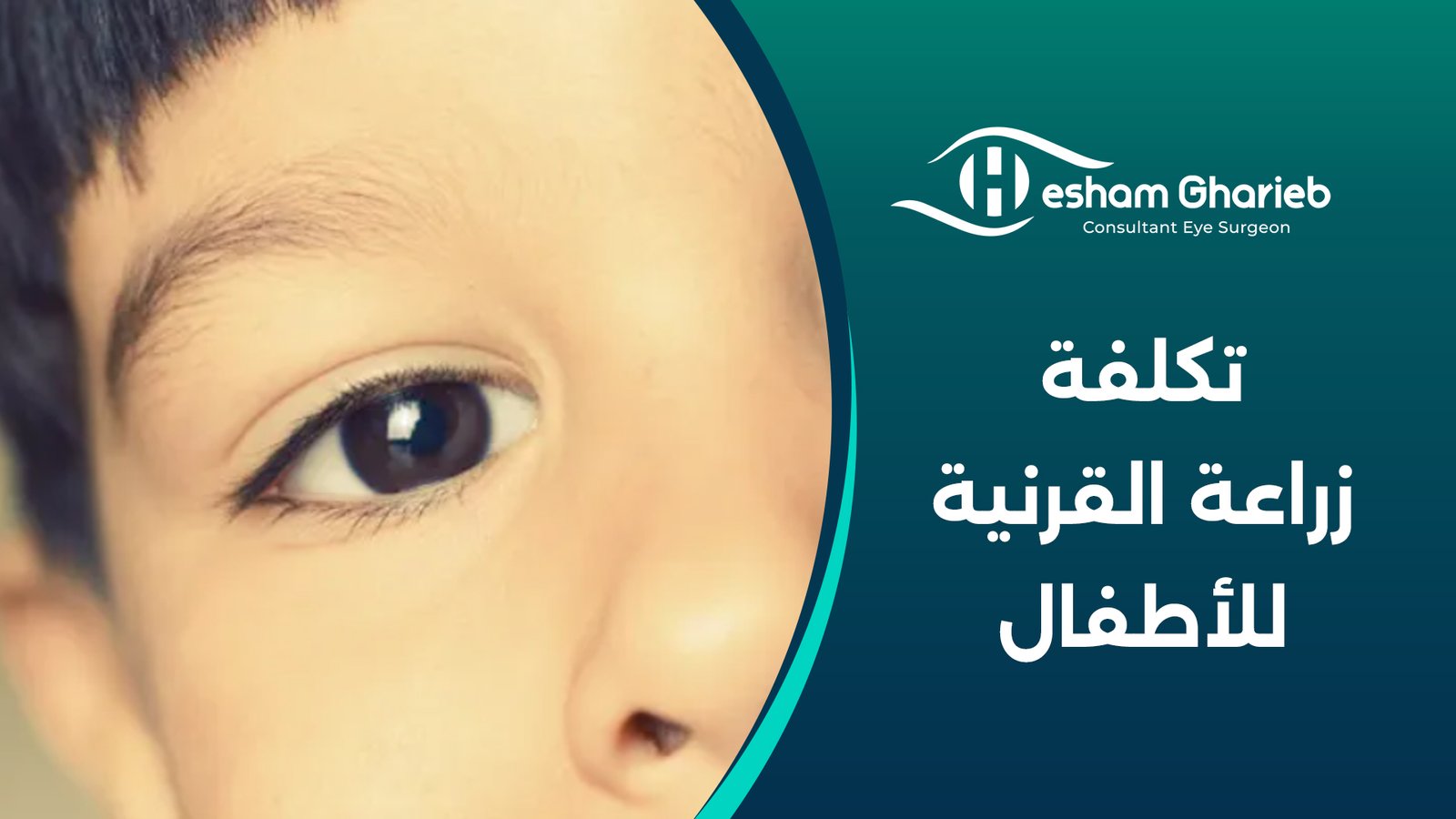 تكلفة زراعة القرنية للأطفال