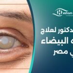 أفضل دكتور لعلاج المياه البيضاء في مصر 2025