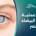 تكلفة عملية المياه البيضاء في مصر – تفاصيل و أسعار