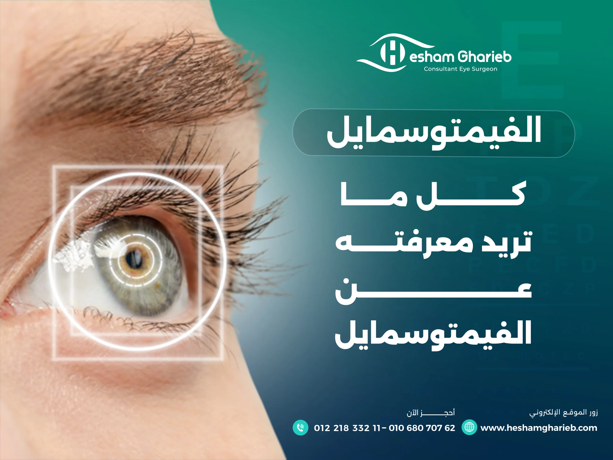 الفيمتوسمايل : كل ما تريد معرفته عن الفيمتو سمايل