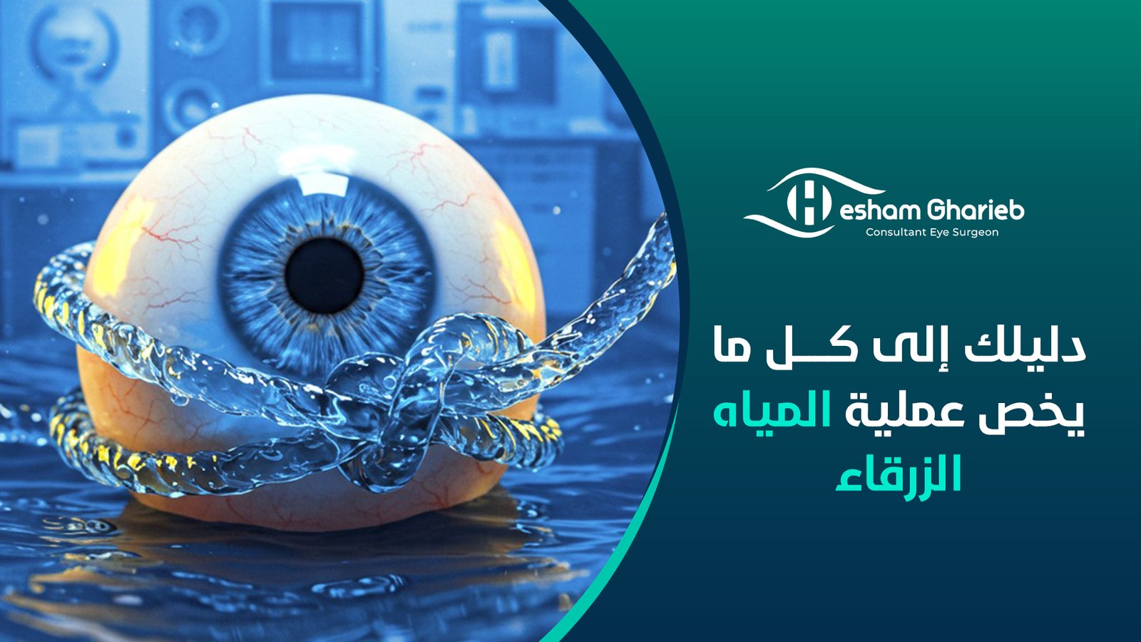 دليلك إلى كل ما يخص عملية المياه الزرقاء