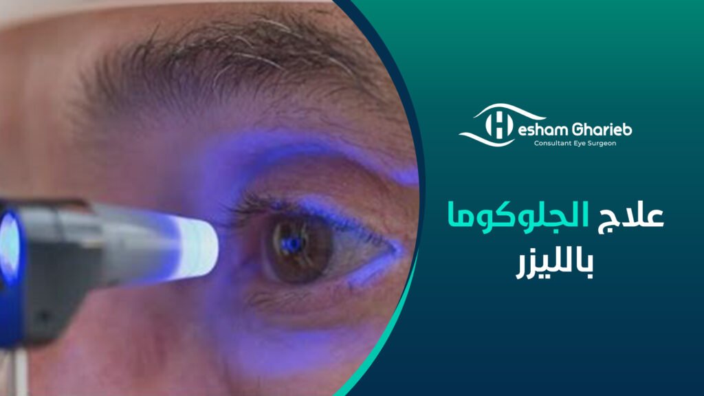 علاج الجلوكوما بالليزر