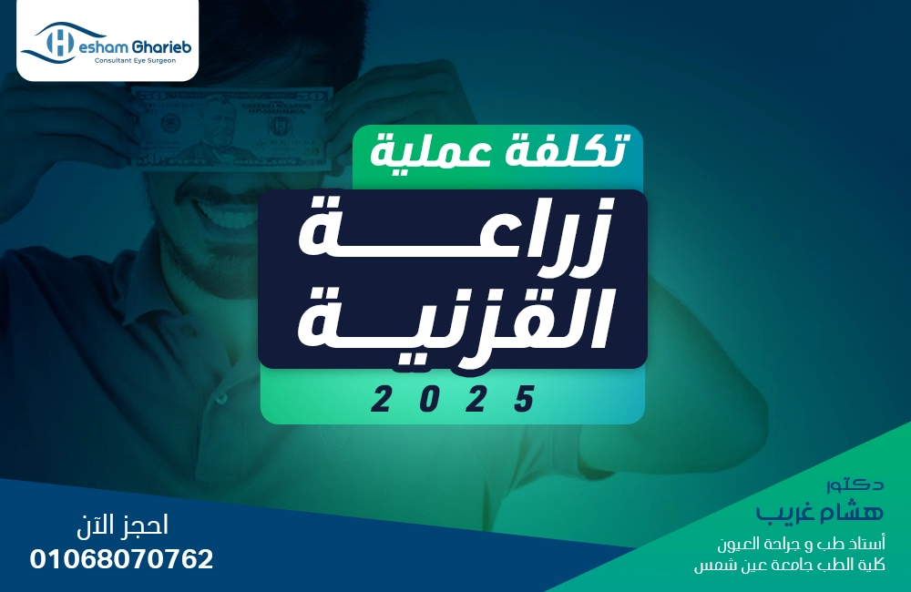تكلفة عملية زراعة القرنية 2025