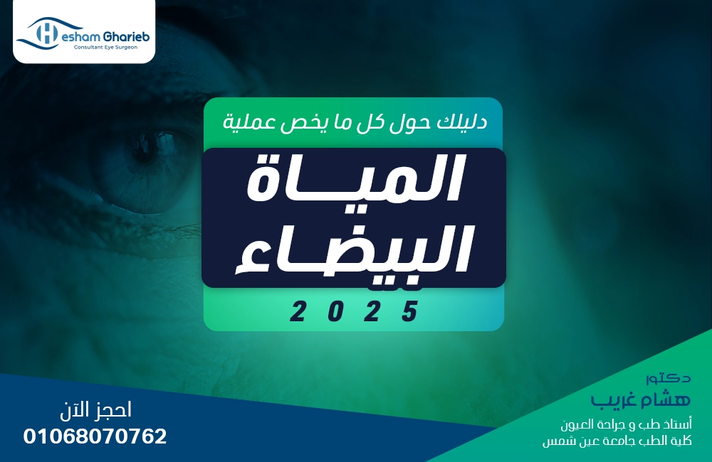 دليلك الشامل إلى أهم 6 أسئلة تخص عملية المياه البيضاء