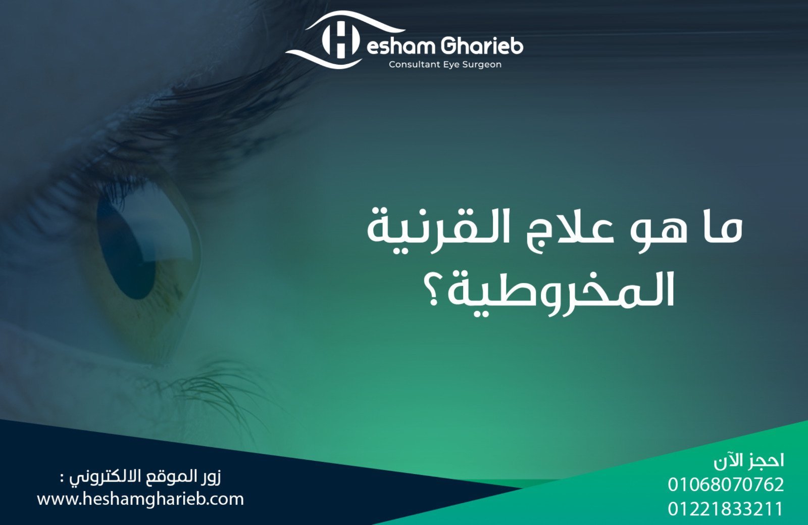 ما هو علاج القرنية المخروطية؟