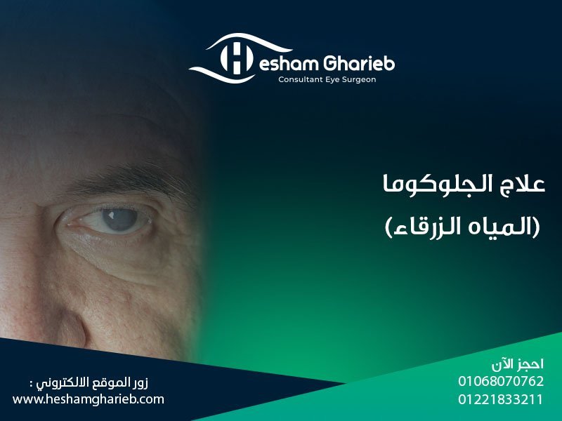 علاج الجلوكوما (المياه الزرقاء) في مصر: الأعراض، الأسباب، وأحدث طرق العلاج 2025